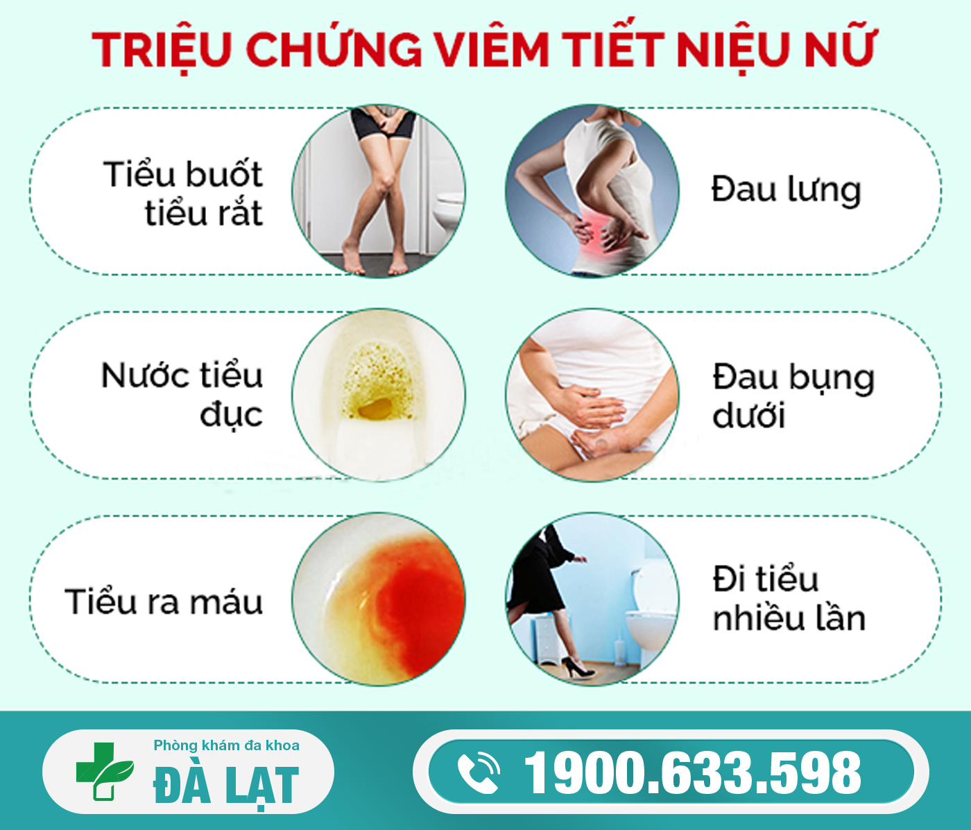 Hình ảnh minh họa